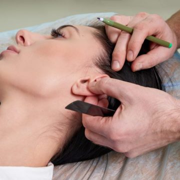 Auriculoterapia